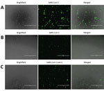 Thumbnail of Severe acute respiratory syndrome coronavirus 2 (SARS-CoV-2) protein detection in infected Vero E6 and CD4+ T cells. To detect SARS-CoV-2 protein expression, we infected Vero E6 and CD4+ T cells with SARS-CoV-2 at a multiplicity of infection of 0.1 for 24 h. We immunostained these cells and observed them by using fluorescent microscopy. A) SARS-CoV-2–infected and immunostained Vero E6 cells. B) SARS-CoV-2–infected and immunostained CD4+ T cells. For panels A and B, cells were staine