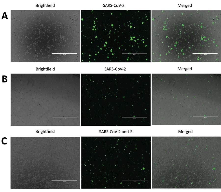 Severe acute respiratory syndrome coronavirus 2 (SARS-CoV-2) protein detection in infected Vero E6 and CD4+ T cells. To detect SARS-CoV-2 protein expression, we infected Vero E6 and CD4+ T cells with SARS-CoV-2 at a multiplicity of infection of 0.1 for 24 h. We immunostained these cells and observed them by using fluorescent microscopy. A) SARS-CoV-2–infected and immunostained Vero E6 cells. B) SARS-CoV-2–infected and immunostained CD4+ T cells. For panels A and B, cells were stained by using an