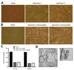 Thumbnail of Isolating severe acute respiratory syndrome coronavirus 2 (SARS-CoV-2) from patients with coronavirus disease (COVID-19). A) Vero E6 cells were mock inoculated or inoculated with midturbinate clinical specimens from COVID-19 patients. Cells were incubated for 72 h and observed for cytopathic effect (CPE) under a light microscope. Original magnification ×10. B) To determine if supernatant from Vero E6 cells that were mock inoculated or inoculated with clinical specimens contained rep