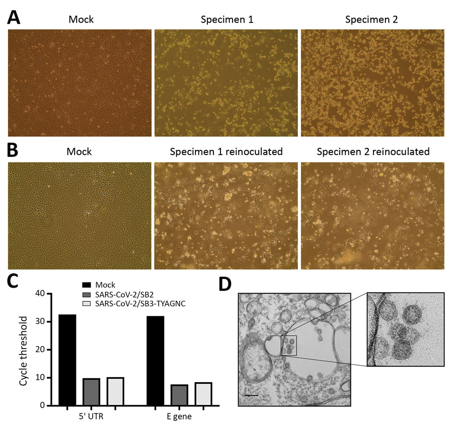 Isolating severe acute respiratory syndrome coronavirus 2 (SARS-CoV-2) from patients with coronavirus disease (COVID-19). A) Vero E6 cells were mock inoculated or inoculated with midturbinate clinical specimens from COVID-19 patients. Cells were incubated for 72 h and observed for cytopathic effect (CPE) under a light microscope. Original magnification ×10. B) To determine if supernatant from Vero E6 cells that were mock inoculated or inoculated with clinical specimens contained replication comp