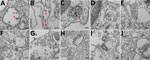 Thumbnail of Electron micrographs of severe acute respiratory syndrome coronavirus 2 (SARS-CoV-2)–infecting cells. To detect coronavirus-like particles in experimentally infected human structural and immune cells, we infected a range of cells with SARS-CoV-2 at a multiplicity of infection of 0.01 for 48 h. The cells were fixed, processed, and imaged by using a transmission electron microscope (10 fields/cell type). A representative image of each cell type is shown. Virus-like particles are indic