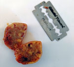 Lymph node removed from ring-tailed lemur in Madagascar that exhibited advanced clinical symptoms consistent with tuberculosis. Blade is 44 mm by 22 mm.