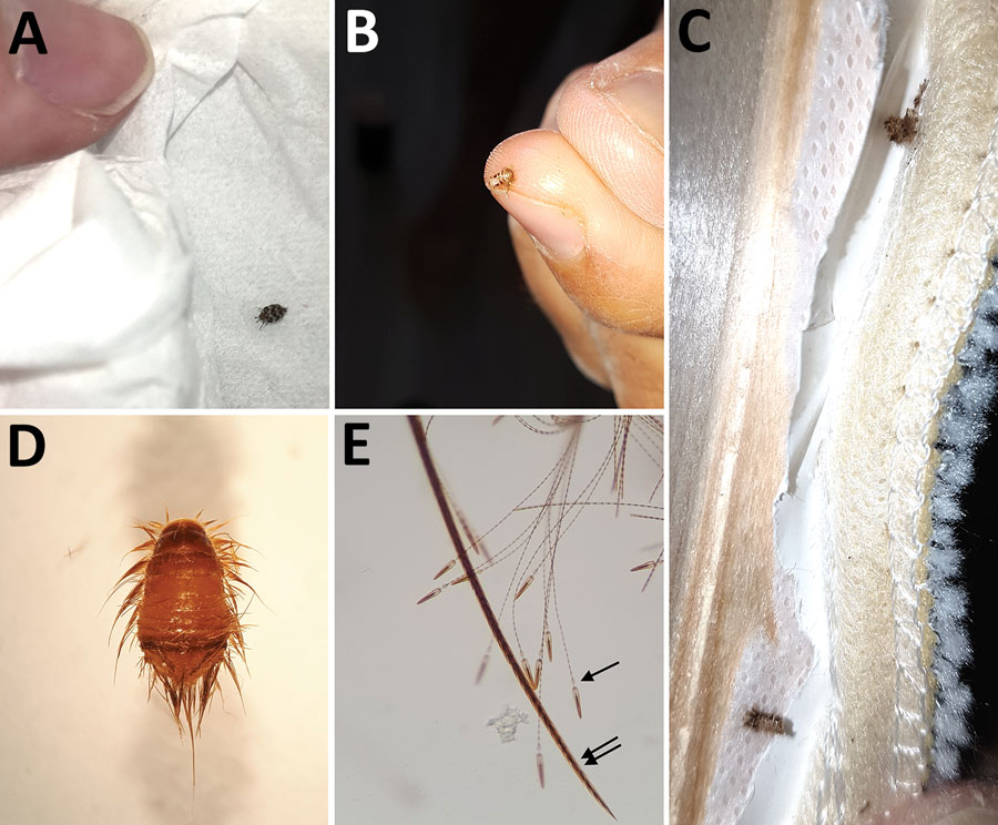 Stages of Anthrenus sp. carpet beetle. A) Adult stage (length 4 mm); B, C) larval stage (length 4 mm) found inside clothing and upholstery fabric; D) larvae (original magnification ×40); and E) larvae (original magnification ×200) showing fine hairs (single arrow) that have a spear-headed shape, are responsible for human hypersensitivity, and are invisible to the naked eye. Double arrow indicates thick larvae hair.