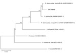 Phylogenetic analysis of concatenated nucleotide sequences from Rickettsia species collected in 2018 from eschar DNA from a patient in Qinghai Tibet Plateau, China (boldface), and reference sequences. A phylogenetic tree was constructed on the basis of the concatenated partial gltA, ompA, ompB, 17 kDa, sca1, and sca4 nucleotide sequences by using the neighbor-joining method with 1,000 bootstrap replicates. Numbers >70 indicate the bootstrapping value. GenBank accession numbers listed in Appendix Table 3 . Scale bar represents nucleotide substitutions.