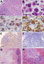 Histopathological lesions in the lymphoid organs from fatal cases of severe fever with thrombocytopenia syndrome (SFTS) in cats, Japan. A) Hematoxylin & eosin (HE)–stained lymph node demonstrating accumulation of blastic lymphocytes around the lymphoid follicle. Scale bar indicates 100 μm. B) HE-stained blastic lymphocytes from the lymph nodes demonstrating highly pleomorphic cells with large clear nuclei and prominent nucleoli, resembling immunoblasts. Scale bar indicates 10 μm. C, D) CD79a-stained (C) and immunohistochemistry-stained (D) blastic lymphocytes from the lymph nodes. Scale bar indicates 10 μm. E) Lymph node stained by immunohistochemistry revealing SFTS virus–positive blastic lymphocytes distributed around the follicle. Scale ar indicates 100 μm. F) Immunohistochemistry-stained hyperplastic lymph node demonstrating no SFTSV-positive cells or necrotic foci. Scale bar indicates 100 μm. G) Necrotic lymphadenitis in HE-stained lymph node. Scale bar indicates 200 μm. H) HE-stained spleen demonstrating necrotic lesions in the splenic follicle. Scale bar indicates 50 μm. 
