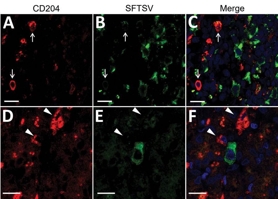 Double-labeling immunofluorescent staining of the lymph node (A–C) and the liver (D–F) from fatal cases severe fever with thrombocytopenia syndrome (SFTS) in cats, Japan. Red indicates signals of CD204. Green indicates signals of SFTS virus. Blue indicates nuclei labeled with DAPI. Arrows in panels A–C indicate CD204-positive macrophages in the lymph node. Arrows in panels D–F indicate CD204-positive kupffer cells in the liver. Scale bars indicate 10 μm. 