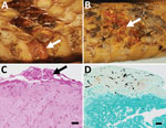 Gross and histologic lesions in museum snake specimens with confirmed ophidiomycosis, United States. A, B) Crotalus horridus (A; University of Wisconsin Zoology Museum [UWZH] accession no. 22773) and Cemophora coccinea (B; UWZH accession no. 13822) specimens with thickened necrotic scales (arrows). C, D) Histologic sections of lesioned skin from the same C. horridus (C; UWZH accession no. 22773) and C. coccinea (D; UWZH accession no. 13822) specimens showing arthroconidia (arrow) and intralesional fungal hyphae consistent with Ophidiomyces ophidiicola infection. Scale bars indicate 20 µm.