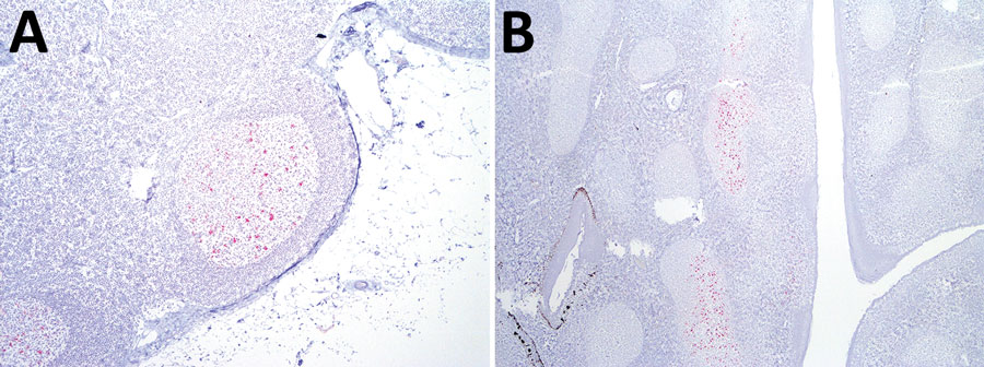 Immunoreactivity against misfolded form of the prion protein (red) in lymphoid tissue from a sheep oronasally inoculated with the agent of chronic wasting disease from white-tailed deer. A) Retropharyngeal lymph node (original magnification ×100.) B) Palatine tonsil (original magnification ×40). We used a cocktail of monoclonal antibodies (F89/160.1.5 and F99/97.6.1).