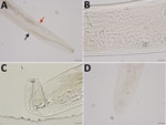 Integrated diagnostic approach for confirming Thelazia callipaeda nematodes: morphologic identification. Specimens were cleared in lactophenol before examination under an Olympus compound microscope (BX53) (https://www.olympus-lifescience.com). Images were taken with an Olympus DP73 camera, and morphometry was performed by using Olympus cellSens software. A) Cephalic end of a female worm. Black arrow indicates esophageal intestinal junction; red arrow indicates vulval opening. Original magnification ×100. B) Transverse striations (150–190/mm) in the cuticle of midbody region of a female worm. Original magnification ×200. C) Buccal cavity of a female worm, wider than deep. Note tightly spaced cuticular striations in the cephalic end. Original magnification ×200. D) Caudal end of female worm with protruding phasmids in the tip. The tail was not protruding unilaterally. Original magnification ×100.