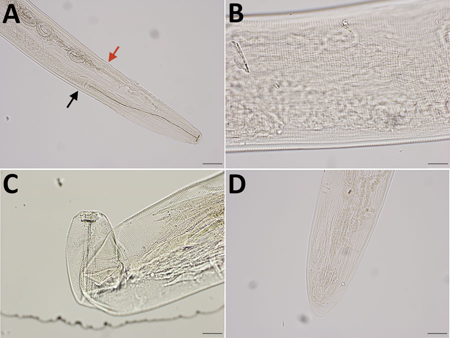 Integrated diagnostic approach for confirming Thelazia callipaeda nematodes: morphologic identification. Specimens were cleared in lactophenol before examination under an Olympus compound microscope (BX53) (https://www.olympus-lifescience.com). Images were taken with an Olympus DP73 camera, and morphometry was performed by using Olympus cellSens software. A) Cephalic end of a female worm. Black arrow indicates esophageal intestinal junction; red arrow indicates vulval opening. Original magnification ×100. B) Transverse striations (150–190/mm) in the cuticle of midbody region of a female worm. Original magnification ×200. C) Buccal cavity of a female worm, wider than deep. Note tightly spaced cuticular striations in the cephalic end. Original magnification ×200. D) Caudal end of female worm with protruding phasmids in the tip. The tail was not protruding unilaterally. Original magnification ×100.