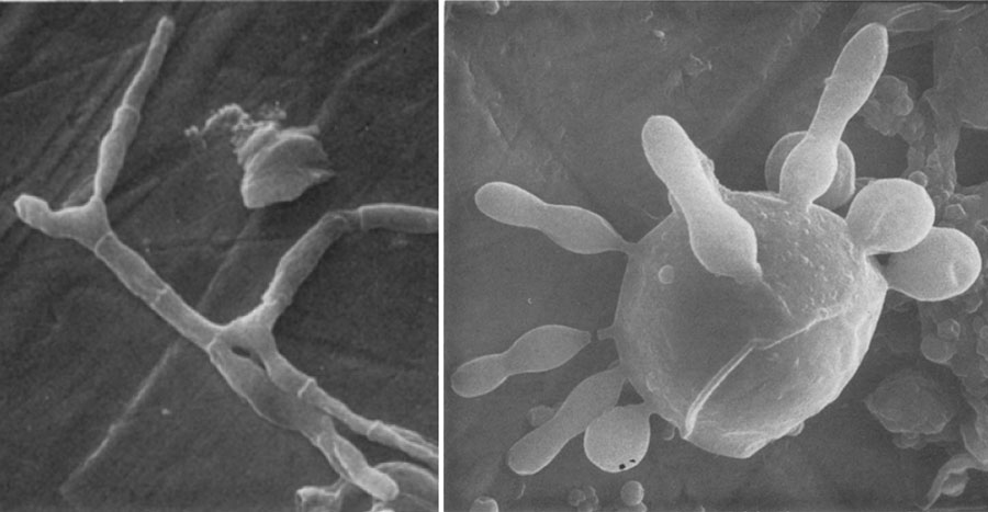 Paracoccidioides brasiliensis mycelium cells (left) and multibudding yeasts (right) by scanning electron microscopy.  Original magnifications ×1,500 for the left panel and ×3,000 for the right panel. Image adapted from Vieira e Silva et al. 1974.