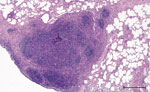 Histopathologic features in red deer in case 2 in study of tuberculosis caused by M. microti in red deer, Austria and Germany. Lung tissue highly infiltrated by round cells, predominantly lymphocytes and some macrophages, single multinucleated Langhans-type giant cells, hematoxylin and eosin stain. Scale bar = 500 μm.