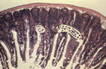 Photomicrograph of an intestinal mucosa tissue specimen showing a Trichinella spiralis parasitic nematode, which had burrowed itself into the columnar epithelial intestinal lining, in a case of trichinosis. Source: CDC/Dr. Robert Kaiser (https://phil.cdc.gov/Details.aspx?pid=14931).