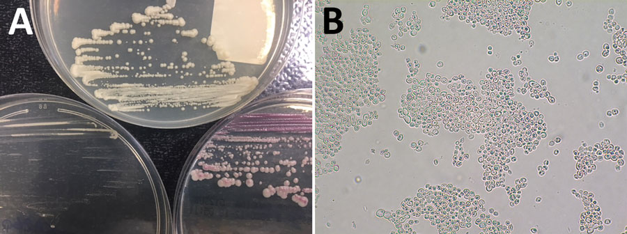 Macroscopic and microscopic examinations of Kazachstania bovina from a patient in Strasbourg, France. A) Macroscopic aspect of K. bovina on 3 agar media: Sabouraud (top), CHROMID Candida (bioMérieux, https://www.biomerieux.fr) (lower left), and CHROMagar Candida (Becton Dickinson, https://www.bd.com) (lower right). B) K. bovina slide-culture on potato carrot bile agar (incubation for 72 h at 27°C, original magnification ×400), showing spherical to ellipsoidal yeast cells with multilateral budding, without filamentation, and some asci containing ascospores.