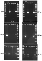 Detection of infectious hypodermal and hematopoietic necrosis virus (IHHNV) in Penaeus vannamei shrimp from the United States by conventional PCR, 2019. Agarose gel photographs show 389-bp IHHNV–specific amplicon (left column) and 309-bp IHHNV–specific amplicon (right column). Top row represents case number 19-490, P. vannamei broodstock samples originating in Florida (A and B). Middle row represents case number 19-428, P. vannamei post-larvae samples originating in Texas (C1 and C2). Bottom row represents case number 19-644, frozen P. vannamei shrimp originating from an indoor farm in Texas (A, B, C, and D). Lane M, 100-bp molecular weight marker (New England Biolabs, Inc., https://www.neb.com); lane SPF, specific pathogen-free P. vannamei shrimp; lane NT, no template control; lane +C, positive control for PCR.