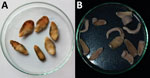 Fasciolopsis buski trematode samples preserved in absolute ethanol. A) Parasites recovered from child patients in Shri Shubh Lal Hospital and Research Centre Hospital, Sitamarhi, Bihar, India. B) Parasites isolated from the intestine of freshly slaughtered pigs in Sivasagar district of Assam.