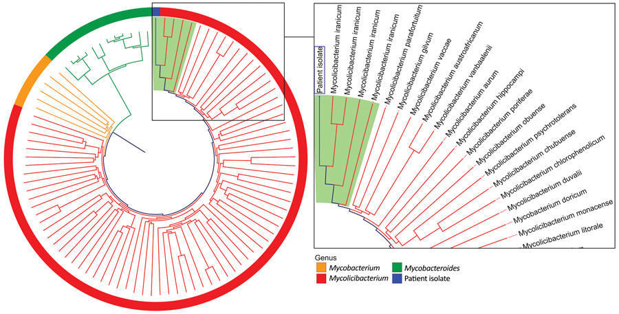 Phylogenetic tree of an isolate from a 76-year old woman in California, USA (blue box), compared with a selection of relevant members of the family Mycobacteriaceae in a case study of catheter-related bloodstream infection caused by Mycolicibacterium iranicum. Relatedness was determined by k-mer analysis. Reference genomes were from 4 Mycolicibacterium iranicum isolates, 74 other Mycolicibacterium spp., 12 Mycobacteroides abscessus isolates, and 6 clinically relevant slow-growing Mycobacterium spp. Light green background indicates M. iranicum isolates. The clinical isolate in this case study was clustered most closely with all 4 M. iranicum genomes. Tree is not scale and is designed to show clustering.