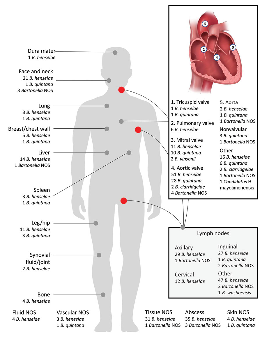 Frequency of Bartonella spp. from different anatomic sites identified during 2003–2021 in study of Bartonella spp. infections identified by molecular methods, United States. Multiple specimens were submitted for 9 patients. We detected Bartonella spp. in both splenic and cardiac specimens from 1 patient, in 2 cardiac specimens each from 7 patients, and in 3 cardiac specimens from 1 patient. If we detected Bartonella spp. on multiple valve specimens, those were included in the total count for all involved valves. For the heart valve inset, other sites are cardiac tissue NOS (n = 18), right ventricular outflow tract conduit (n = 3), pacemaker or implantable cardiac device lead (n = 4), and coronary cusp (n = 1). For the lymph node inset, other sites are lymph node NOS (n = 38), supraclavicular (n = 3), submental (n = 2), mesenteric (n = 1), preauricular (n = 1), submandibular (n = 1), epitrochlear (n = 1), jugular (n = 1), iliac (n = 1), and paraspinal (n = 1). NOS, not otherwise specified.