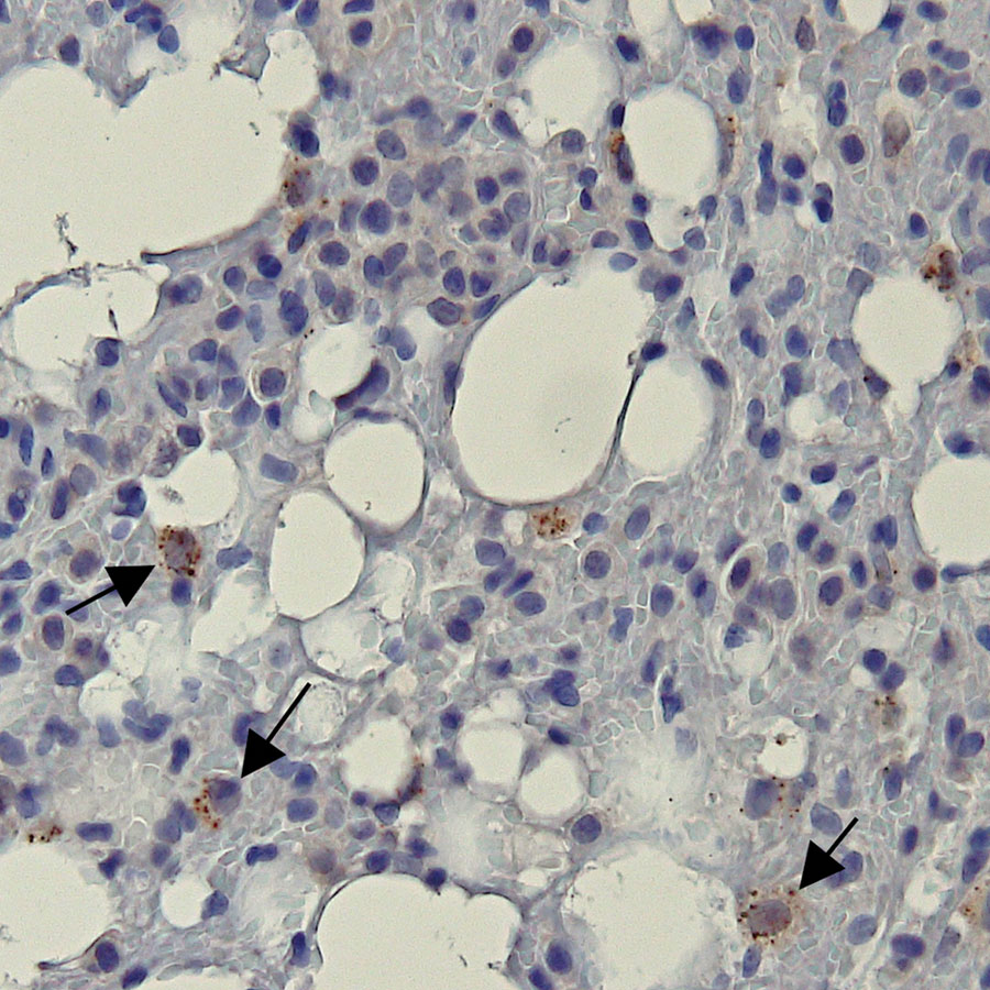 Representative bat lung tissue showing Ebola virus (EBOV) cytoplasmic granules in study of histopathologic changes in Mops condylurus bats naturally infected with Bombali virus, Kenya. We labeled lung tissue sections by using rabbit polyclonal serum against EBOV matrix protein VP40 and detected antigen by using a chromogenic horse radish peroxidase substrate. The sections were then counterstained with hematoxylin. Arrow indicates granular cytoplasmic immunopositivity for EBOV VP40 antigen. Original magnification ×400. VP, viral protein.