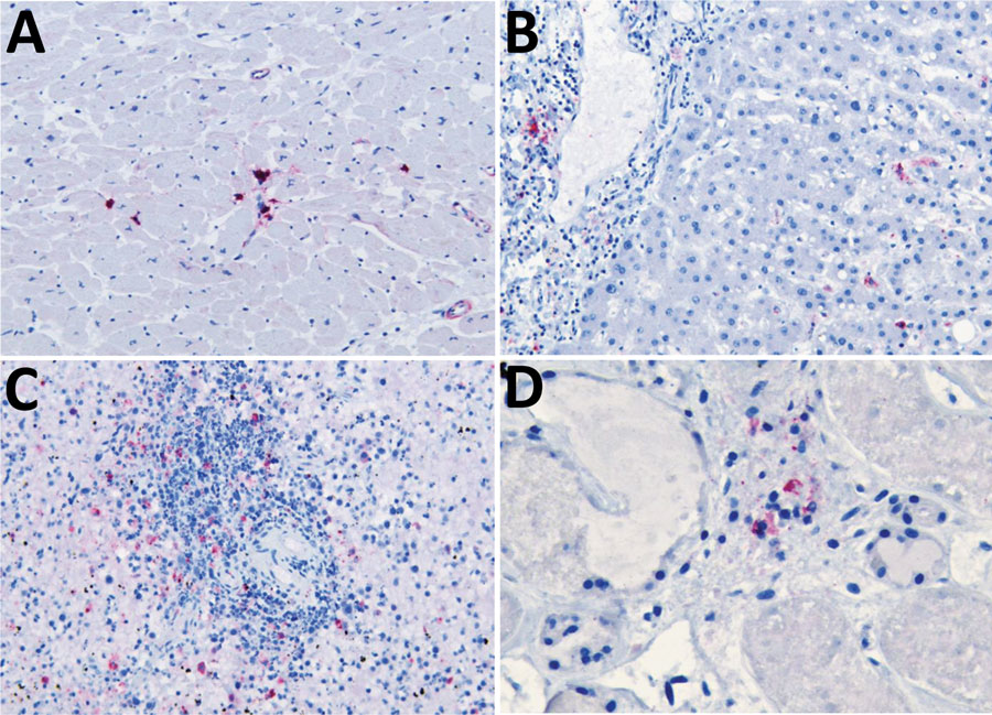 Viral immunostaining of samples from a fatal case of heartland virus disease acquired in the mid-Atlantic region, United States. Heartland virus antigen was detected in multiple organs. A) Mononuclear interstitial inflammatory cell of myocardium. Original magnification ×20. B) Periportal macrophages and Kupffer cells in liver. Original magnification ×20. C) Large hematopoietic cells of spleen. Original magnification ×20. D) Inflammatory interstitial cells of kidney. Original magnification ×40.