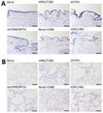 Tissue tropism of influenza A viruses in ex vivo cultures of human bronchus and lung tissue. Immunohistochemical staining of influenza A nucleoprotein in ex vivo cultures of human bronchial tissues (A) and lung tissues (B) at 48 hours postinfection with H9N2/Y280, pH1N1, H3N8/MP16, novel H3N8, and H5N1/483 viruses. Positive cells are indicated by red-brown color. Images are representative of 3 individual donors. Scale bar indicates 100 μm. Detailed information on viruses used in study is provided in the Appendix .