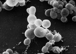 Scanning electron microscopic image of Malassezia furfur reproductive fungal spores. Source: Public Health Image Library, Centers for Disease Control and Prevention (https://phil.cdc.gov). Photograph credit: Janice Haney Carr.