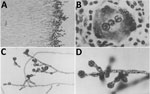 Micrographs showing tissue and culture analyses of a fungal infection case described by Medlar in 1915. A) Section of 5-week-old colony. B) Muriform bodies inside a giant cell. C) Hyphae in a 4-week-old colony. D) Aerial hypha showing numerous, typical sporogenous cells. 