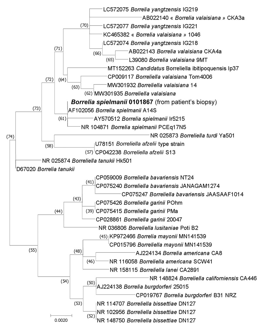 Maximum-likelihood phylogenetic tree of the 16s rRNA gene (rrs) of Borrelia genus bacteria showing the position of the B. spielmanii sequence obtained from the patient (large bold font) Evolutionary analyses were conducted using TOPALi version 2.5 (http://www.topali.org). The sequences of the 16S rDNA amplified in this study with other 12S rDNA tick sequences available on GenBank (910 positions in the final dataset) were aligned using ClustalW (https://www.genome.jp/tools-bin/clustalw) implemented on BioEdit version 3 (https://bioedit.software.informer.com). The evolutionary history was inferred by using the maximum likelihood method based on the Hasegawa–Kishino–Yano model plus invariate sites plus gamma distribution. The percentage of trees in which the associated taxa clustered together is shown next to the branches. GenBank accession numbers are provided. Scale bar indicates nucleotide sequence divergence.