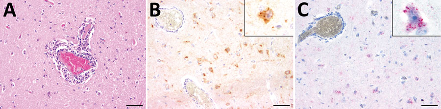 Histopathologic, immunohistochemical, and in situ hybridization findings in the cerebrum of a lion tested positive for rustrela virus (RusV) by quantitative reverse transcription PCR. A) Histopathologic analysis of cerebral sample from lion 3 indicated lymphohistiocytic meningoencephalitis and vasculitis. B) Immunohistochemistry analysis showed RusV antigen in cortical neurons and their processes. Cytoplasmic granular immunoreactivity is visible (inset). C) In situ hybridization revealed RusV RNA in cortical neurons; we observed cytoplasmic granular-positive signal (inset). Scale bars indicate 50 µm.