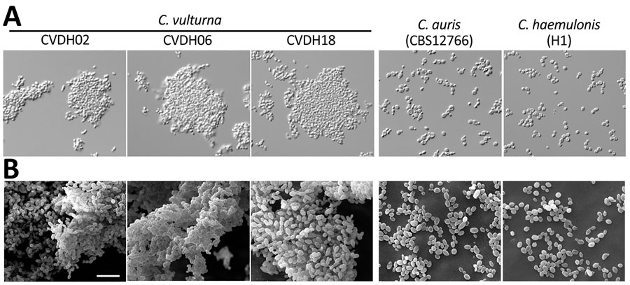 Morphologies of 3 representative C. vulturna isolates from 19 infected patients in Shanxi Province, China, January 1, 2019–October 26, 2022. C. auris (CBS12766) and C. haemulonii (H1) served as reference strains. A) Adhesion phenotypes of C. vulturna isolates grown in liquid Lee’s glucose medium at 30°C for 24 h. Strains CVDH02, CVDH06, and CVDH18 exhibited strong adhesiveness, whereas the C. auris and C. haemulonii reference strains grew as separate single cells under the same culture conditions. B) Biofilm formation of C. vulturna isolates. C. auris (CBS12766) and C. haemulonii (G7) served as reference strains. Biofilms were developed on silicone squares at 30°C for 48 h. Lee’s glucose medium was used for biofilm growth. Scale bar indicates 10 µm. Morphologies for the other 16 C. vulturna isolates and 2 C. auris strains are shown in Appendix Figure 3.