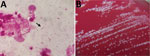 Detection and colonization of Desulfovibrio desulfuricans in an 84-year-old man in Japan who had undergone endovascular aortic repair 9 years earlier. A) Gram stain of pus. D. desulfuricans MB has a gram-negative spiral rod appearance (arrow). Original magnification ×1,000. B) Colonies of D. desulfuricans MB on ABHK agar. Biochemical properties showed positive results for catalase and negative for indole and urease. In vitro susceptibility testing revealed that it had the following MICs: meropenem, <2 μg/mL; cefotaxime, <2 μg/mL; ampicillin/sulbactam, <4 μg/mL; piperacillin/tazobactam, <16 μg/mL; and clindamycin, >8 μg/mL.