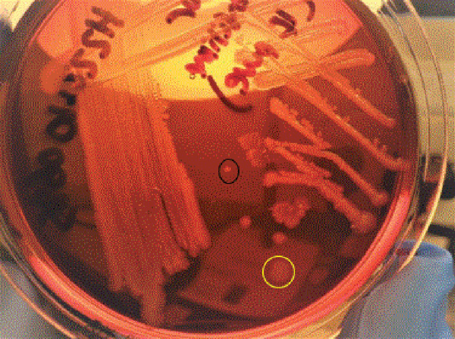 Salmonella Typhi colony on MacConkey agar, isolated from patient during clinical relapse of carbapenem-resistant Salmonella Typhi infection, Pakistan, 2022. Variant 1, circled in yellow, is a large gray dull colony. Variant 2, circled in black, is a small whitish shiny colony.