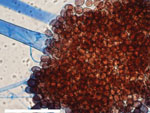 Choanephora infundibulifera 的显微形态显示带有孢子囊的孢子囊和孢子囊孢子，来自胶带安装在香蕉叶琼脂上 25°C 7 天。 比例尺表示 100 µm。 