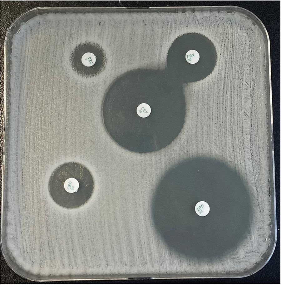 Disk diffusion testing for antimicrobial susceptibility testing of Staphylococcus succinus from a patient in France with infective endocarditis. Agar diffusion method using impregnated disks was interpreted according to the criteria of the European Committee on Antimicrobial Susceptibility Testing 2022 (version 13.0) breakpoints for oxacillin susceptibility testing (https://www.eucast.org/fileadmin/src/media/PDFs/EUCAST_files/Breakpoint_tables/v_13.0_Breakpoint_Tables.pdf). CEF, cephalotin; CRO: cefotaxime (PBP2); FOX, cefoxitin (PBP4); IMP, imipenem (PBP1); OXC, oxacillin (PBP3); PBP, penicillin-binding protein.