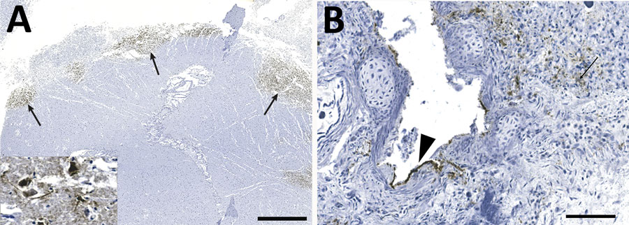 Detection of influenza virus antigen by immunohistochemistry in brain (A) and lung (B) of harbor seals (Phoca vitulina) infected by highly pathogenic avian influenza A(H5N1) virus, St. Lawrence Estuary, Quebec, Canada, 2022. A) Brain tissue. Multifocal areas of intense immunostaining (arrows) with staining of all structures are seen in the affected area, including neurons and neuropil (inset). Scale bar indicates 2 mm. B) Lung tissue. Positive immunostaining can be observed within alveolar septae (arrow) and in bronchiolar epithelial cells (arrowhead). Scale bar indicates 80 µm.