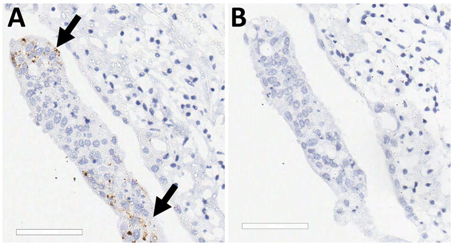 SARS-CoV-2 infection of tracheal explant in study of SARS-CoV-2 seropositivity in urban population of wild fallow deer, Dublin, Ireland, 2020–2022. Tracheal explants from 2 SARS-CoV-2–seronegative deer were inoculated with SARS-CoV-2 Italy-INMI1 and stained by using immunohistochemistry. Control sections were stained with IgG only or mock infected. A) Arrows indicate SARS-CoV-2 Italy-INMI1 antigen immunoreactivity in tracheal epithelium; B) no immunoreactivity was observed after staining with the IgG control. Scale bars indicate 60 μm. 