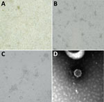 Microscopic appearance of Issyk-Kul virus IT-297348-34/2022, isolated from a Hypsugo savii bat, in study of batborne neglected zoonotic agent Issyk-Kul virus, Italy. A) Issyk-Kul–infected MARC 145 cells, mock infection; original magnification ×10. B) Issyk-Kul–infected MARC 145 cells showing cytopathic effect at 120 hours after infection; original magnification ×4. C) Issyk-Kul–infected MARC 145 cells showing cytopathic effect at 120 hours after infection; original magnification ×10. D) Negative-staining electron microscopy performed on cell supernatants (NaPT 2%), showing a viral particle of 55–60 nm morphologically referable to nairovirus; original magnification ≈x550,000