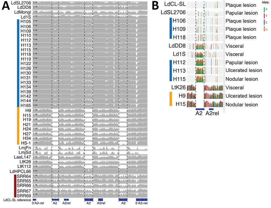 Coverage plots of whole-genome sequencing reads mapped to the reference strain L. donovani cutaneous leishmaniasis from Sri Lanka. A) The absence of reads on the A2 gene locus in the classic cutaneous species (L. major and L. tropica) indicates a truncated pseudogene sequence. B) Variable levels of sequence heterogeneity for the A2 gene are observed among the different L. donovani clinical isolates from Sri Lanka. Plaque skin lesion phenotype was associated with A2 gene sequences that are highly similar to the reference. SL, Sri Lanka.