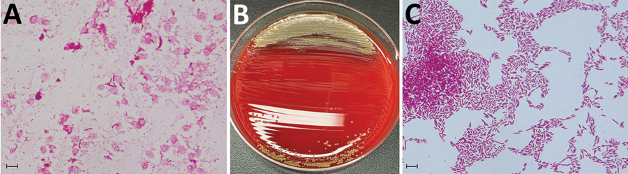 Identification of Sphingobium yanoikuyae bacteremia in 89-year-old man, Japan. A) Gram stain of the organisms growing in a blood sample incubated in a BACTEC Plus Aerobic/F Culture Vial (Becton Dickinson, https://www.bd.com). Scale bar is 10 μm. B) Colonies of S. yanoikuyae cultured on Trypticase Soy Agar with 5% Sheep Blood (Becton Dickinson). C) Gram stain of S. yanoikuyae bacteria from a colony obtained by subculturing positive blood culture fluid on Trypticase Soy Agar with 5% Sheep Blood at 35°C in an aerobic environment. Scale bar is 10 μm.