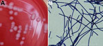 Preserved isolate from a bacteriologic and genomic investigation of Bacillus anthracis from World War II site, China. A) Morphological analysis of B. anthracis isolated on polymyxin B-lysozyme-EDTA-thallous acetate agar plate showing classic B. anthracis features: gray, opaque, medium sized, irregular-shaped colonies with a ground glass surface and no surrounding hemolytic rings. B) Gram staining showing B. anthracis bamboo-like arrangement. Scale bar represents 30 μm. Isolate data are available in GenBank (accession no. BA20200413YY).