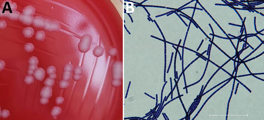 Preserved isolate from a bacteriologic and genomic investigation of Bacillus anthracis from World War II site, China. A) Morphological analysis of B. anthracis isolated on Columbia blood agar plate showing classic B. anthracis features: gray, opaque, medium sized, irregular-shaped colonies with a ground glass surface and no surrounding hemolytic rings. B) Gram staining showing B. anthracis bamboo-like arrangement. Scale bar represents 30 μm. Isolate data are available in GenBank (accession no. CPI3355587–89).