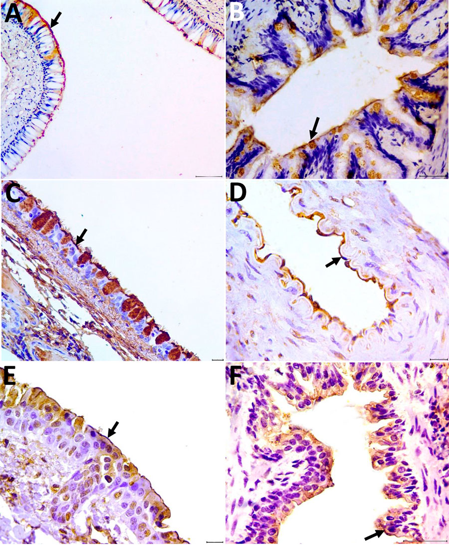 Detection of α-2,3 and α-2,6 receptors in tissues from the respiratory system of coatis (Nasua nasua), Brazil. A–C) Arrows indicate immunolabeling of the α-2,3 receptor in the ciliated epithelium for the lectin Maackia amurensis II of the nasal concha (A), lung (bronchiole) tissue (B), and trachea (C). Scale bars = 100 µm in panel A, 50 µm in panel B, and 20 µm in panel C. D–F) Arrows indicate immunolabeling of the α-2,6 receptor in the endothelium for Sambucus nigra lectin in the arteriole (D), rostral concha (E), and lung (bronchiole) (F). Scale bars = 20 µm in panels D and E, 50 µm in panel F. Tissue was counterstained with hematoxylin and revealed with diaminobenzidine chromogen.