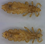 Two female body lice, Pediculus humanus humanus, collected from a person experiencing homelessness in inner city Winnipeg, Manitoba, Canada (9).