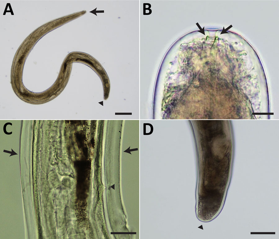 Light micrographs of Pelecitus sp. nematode isolated from the left eye of a 61-year-old man in Thailand. A) Curled female, 3.5 mm in length and 198 µm in width. Head (arrow) and tail (arrowhead) are indicated. Scale bar = 250 μm. B) Rounded anterior extremity with preesophageal cuticular ring (arrows). Scale bar = 10 μm. C) Postdeirid (arrowhead) at the posterior left side and lateral alae (arrows) at the posterior part. Scale bar = 50 μm. D) Rounded posterior extremity (arrowhead). Scale bar = 100 μm. 