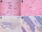 Microscopic findings of cetacean morbillivirus infection in 2 humpback whales in southern Brazil, 2022 (Megaptera novaeangliae). A) Cerebral cortex from whale MN2,. Note the pronounced perivascular cuffs composed of lymphocytes and plasma cells, moderate gliosis, and discreet vacuolization of the white matter. Hematoxylin and eosin stain; original magnification ×200. B) Cerebral cortex from whale. Eosinophilic intracytoplasmic inclusion body in a neuronal cell (arrow). Hematoxylin and eosin stain; original magnification ×400. C) Cerebral cortex from whale MN2. Neurons and astrocytes show severe, multifocal, cytoplasmic immunostaining with a marked perivascular lymphoplasmacytic cuff. Immunohistochemistry anti-canine distemper virus, morbillivirus; original magnification ×100. D) Cerebellum from MN2. Purkinje cells exhibit pronounced, multifocal, cytoplasmic immunostaining. Inset: Intense and granular immunostaining is observed in the cell body, in the dendrites of Purkinje cells, and occasionally in granule cells. Immunohistochemistry anti-canine distemper virus, morbillivirus; original magnification ×400.
