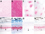 Immunohistochemistry demonstrating misfolded prion protein in white-tailed deer oronasally inoculated with white-tailed deer scrapie (WTD scrapie) agent in study of scrapie versus chronic wasting disease (CWD) in white-tailed deer. A) Vacuolation in the dorsal motor nucleus of the vagus in the brain stem at the level of the obex of each deer. B–D) Misfolded prion protein in the dorsal motor nucleus of the vagus in the brain stem at the level of the obex (B), palatine tonsil (C), and retropharyngeal lymph node (D) of each deer. E–H) Neurotropism of the scrapie form of the prion protein for retinal ganglion cells with scrapie agent (closed arrowheads) and not CWD (open arrowhead). E) Sheep scrapie retina; F) WTD scrapie, passage 1, retina; G) WTD scrapie, passage 2, retina; H) WTD CWD, retina. Hematoxylin and eosin staining; original magnification ×10 for panels A–D, ×20 for panels E–H. GCL, ganglion cell layer; INL, inner nuclear layer; IPL, inner plexiform layer; ONL, outer nuclear layer; OPL, outer plexiform layer.