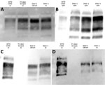 Epitope mapping on Western blots with antibodies that progress toward the N-terminal of the prion protein in study of scrapie versus CWD in white-tailed deer. C-terminal antibodies 6H4 (A) and SHA31 (B) were used to probe brain and lymphoid tissue (representative samples). C) Material from the second passage of WTD scrapie and CWD, both responsive to probing by the N-terminal antibody 12B2. D) WTD scrapie material showing no or low affinity to the N-terminal antibody P4. CWD, chronic wasting disease; P1, first passage; sc, cervical spinal cord; cbrum, cerebrum; rpln, retropharyngeal lymph node; WTD, white-tailed deer.