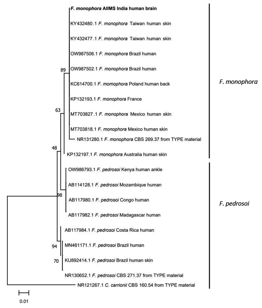 Phylogenetic relatedness of the isolate cultured from the brain biopsy sample from a 3-year-old patient in India with Fonsecaea monophora fungus infection (bold) compared with selected global isolates of Fonsecaea spp. Tree was derived by using the maximum-likelihood method with Kimura 2 parameter model and 1,000 bootstrap replicates implemented in MEGA 11.0.13 (MEGA, https://www.megasoftware.net).