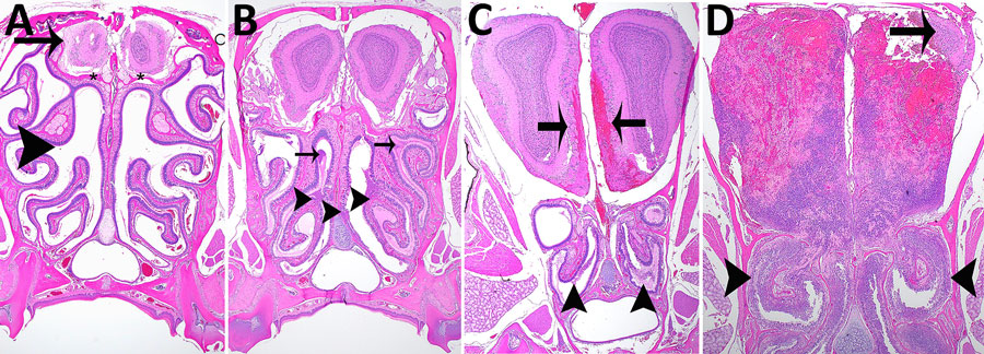 Hematoxylin and eosin staining of head sections of C57BL/6 mice exposed to aerosolized Burkholderia pseudomallei strain ATS2021, the causative strain in an an outbreak of 4 cases, 2 of them fatal, in the United States in 2021. Shown are the nasal cavity (including nasal turbinates, nasal septum, respiratory and olfactory epithelium, lamina propria with supporting tissues and glands, nerve bundles, and nasal air passages); cribriform plate (bone and olfactory/trigeminal nerves); and cranial vault with olfactory bulb. A) Day 1 after exposure, dose 107 CFU, showing nasal turbinates (arrowhead), cribriform plate (asterisks), and olfactory bulb (arrow) that are essentially normal. Original magnification ×2. B) Day 2 after exposure, dose 4,490 CFU, showing mild necrosuppurative rhinitis (arrowheads) with edema, cellular debris and suppurative inflammation in few nasal air passages (arrows). Original magnification ×2. C) Day 3 after exposure, dose 4,490 CFU, showing multifocal moderate necrosuppurative rhinitis (arrowheads) and necrotizing and hemorrhagic meningoencephalitis of the olfactory bulb (arrows). Original magnification 2. D) Day 4 after exposure, dose 1,150 CFU. There is diffuse necrosuppurative rhinitis of the nasal turbinates (arrowheads), showing extensive necrosis and hemorrhage of the olfactory bulb with a small portion of recognizable neural tissue evident (arrow). Original magnification ×2.