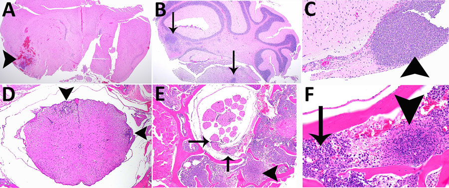 Histopathologic analyses of the neurologic system of C57BL/6 mice after inhalation of Burkholderia pseudomallei strain ATS2021, the causative strain in an an outbreak of 4 cases, 2 of them fatal, in the United States in 2021. A) Day 5 after exposure of group 4 mouse 45, dose 1,150 CFU. Cerebrum showing focally extensive necrotizing and hemorrhagic meningoencephalitis (arrowhead). Hematoxylin and eosin (HE) stain; original magnification ×2. B) Day 9 after exposure, dose 107 CFU. Pons and cerebellum. There is multifocal necrotizing meningoencephalitis (arrows). HE stain; original magnification ×2. C) Day 10 after exposure, dose 1,150 CFU. Cerebrum with olfactory peduncle filled with viable and degenerate neutrophils with no recognizable peduncular tissue (arrowhead). HE stain; original magnification ×20. D) Day 9 after exposure, 107 CFU. Spinal cord, thoracic, shows multifocal meningomyelitis (arrowheads). HE stain; original magnification ×4. E) Day 5 after exposure, 1,150 CFU. Spinal cord and vertebrae, lumbar at cauda equina, show is multifocal suppurative perineuritis of spinal nerves (arrows). Note the necrotizing lesion within the vertebral bone marrow (arrowhead) HE stain; original magnification ×10. F) Day 4 after exposure, dose 1,150 CFU. Spinal cord and vertebra, thoracic, show necrotizing osteomyelitis (arrowhead). Note the loss of distinction of bone marrow cells compared to normal cells of the bone marrow (arrow). HE stain; original magnification ×40.